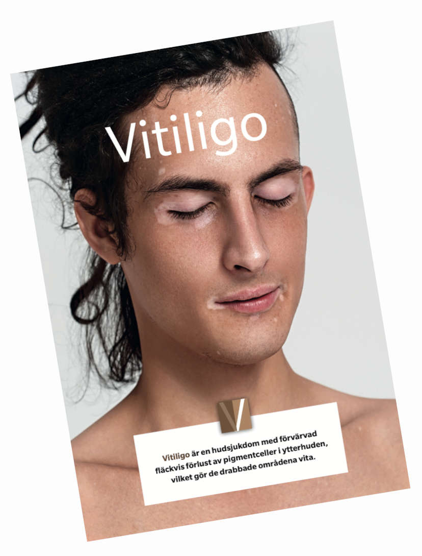 vitiligoförbundet broschyr